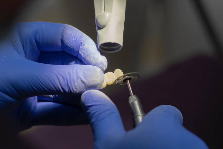 Ile kosztują implanty zębowe i gdzie szukać takich usług?